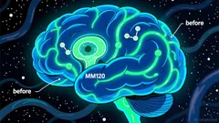 MNMD: Is This Psychedelic Biotech Stock a 2026 Game Changer?