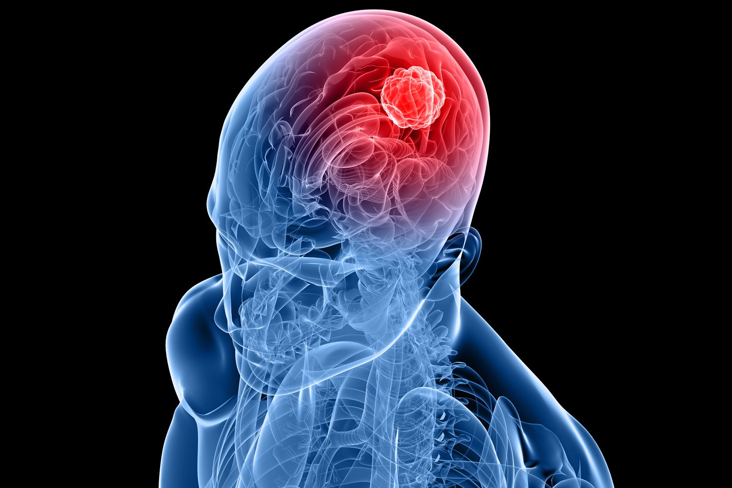Alpha Tau Medical: A Real FDA Green Light, Priced for the Early Signal ...